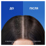 Шампунь Head & Shoulders Свіжість ментолу Проти лупи 400 мл (5011321336094) Шампунь Head & Shoulders Свіжість ментолу Проти лупи 400 мл (5011321336094)
