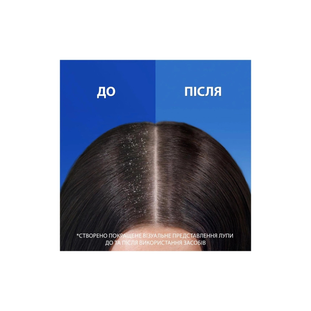 Шампунь Head & Shoulders Проти лупи Яблучна свіжість 800 мл (8700216306782)